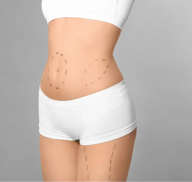 Gastric Bypass Surgery