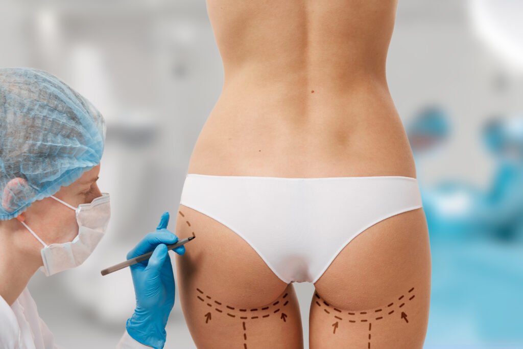 Buttock Contouring in Delhi