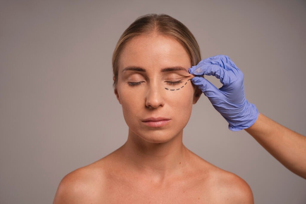 Eyelid Correction Surgery in Delhi